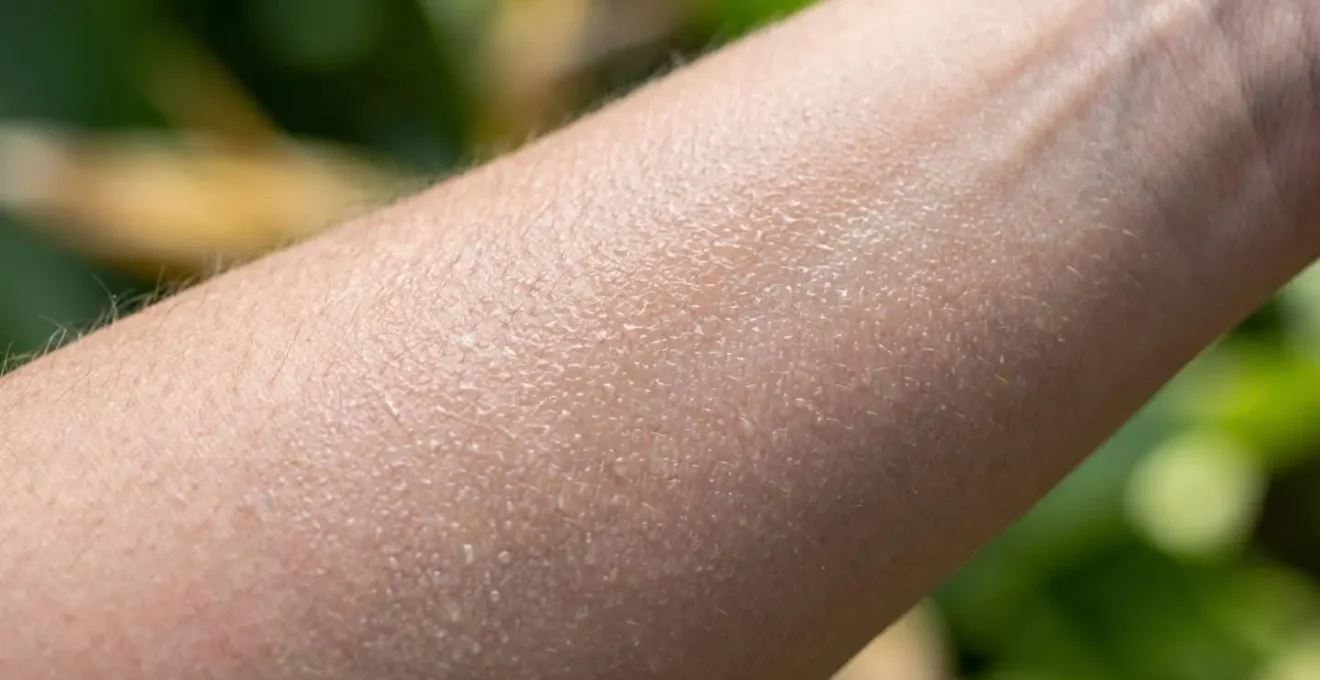 Détail macro de la texture d'une peau protégée avec application invisible de répulsif de qualité